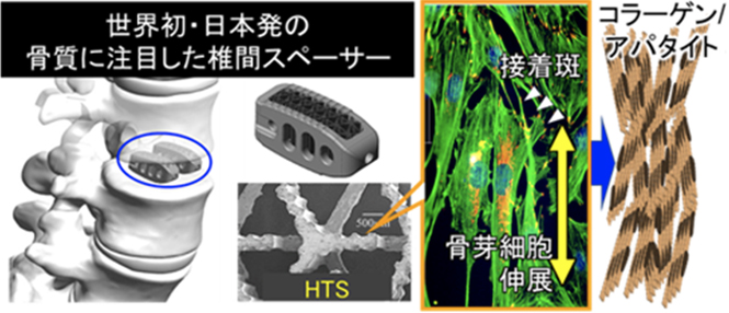 1.医療部門（骨質医療デバイス等）
